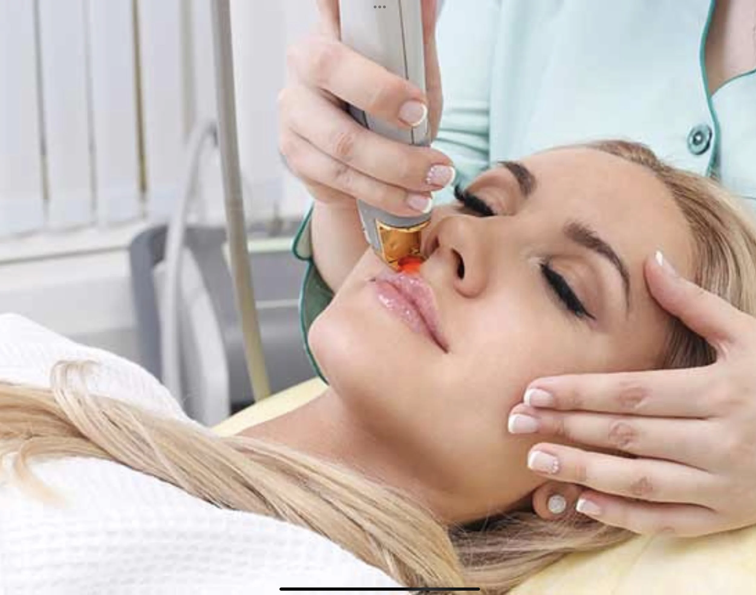 Laser Hair Removal, lip hair removal, facial hair  Livingston , Mid Calder, East Calder , West Lothian