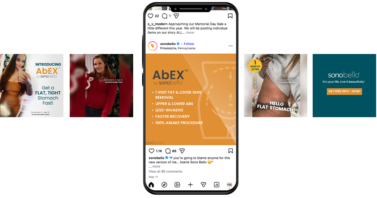 Instagram post showing Sonobello's AbEX body contouring procedure, highlighting benefits such as fat removal, less-invasive, and faster recovery; includes before and after photos and promotional content.