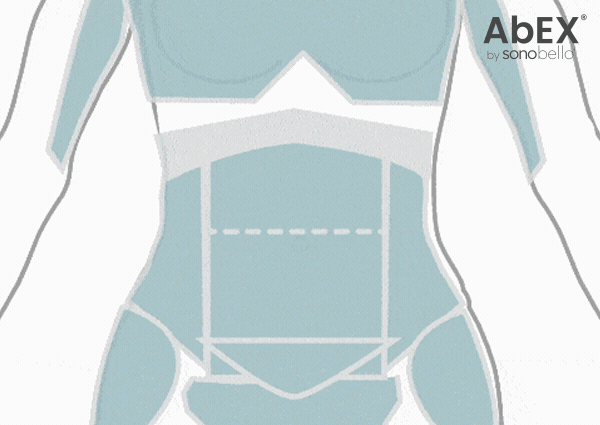 Diagram of a human abdomen with different zones marked for abdominal body composition analysis.