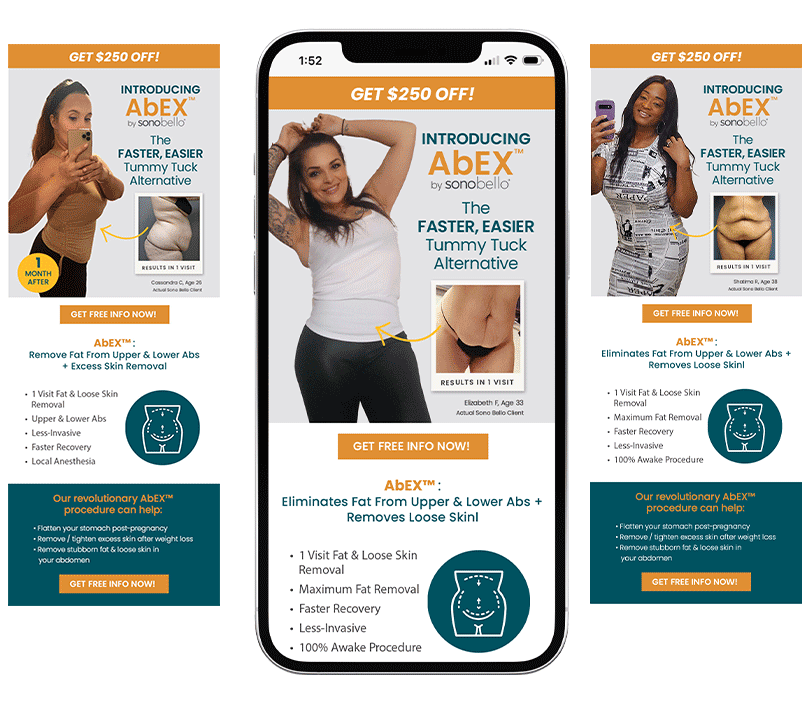 Digital advertisement for AbEX, a tummy tuck procedure, showing three women with slim waistlines, one taking a selfie, another flexing her arm, and the third smiling while holding her phone. The ad highlights a promotion of $250 off, features a before-and-after image of a belly, and lists benefits such as fat removal and quicker recovery.