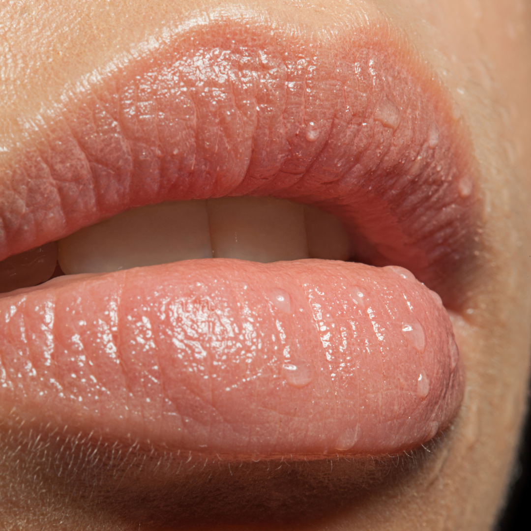 Is a Lip Flip the Subtle Pout Enhancement You’ve Been Looking For?