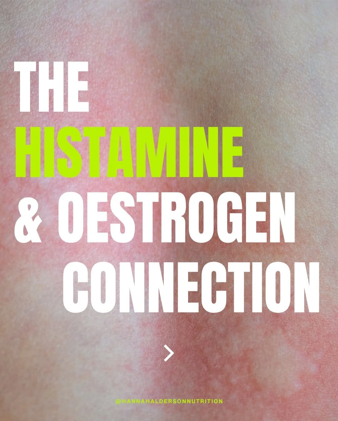 Hormonal symptoms feeling loud? Histamine could be the culprit! 

Histamine and oestrogen have a surprisingly close relationship and for some women, this can explain why symptoms feel worse at certain points in the cycle 🙁 This relationship can be v