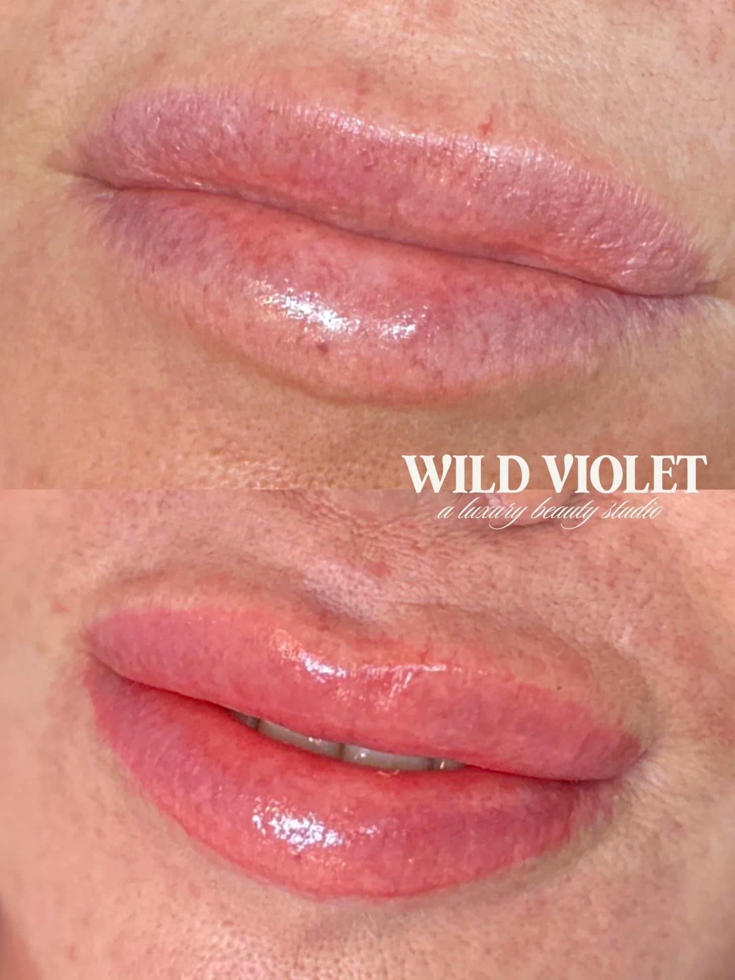 Subtle, but dramatic lip blush results

This client asked for an enhancement of her natural color and a more even tone overall. She couldn&rsquo;t stop staring at herself in the mirror on her way out 🙌🏼🫶🏼

Did you know we offer a brow + lip bundl