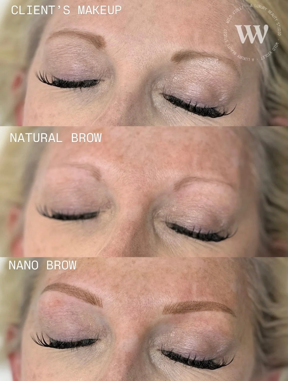 NANO BROW 

Subtle shape adjustments go a long way and this client was so pleased with her brow enhancement. 

IN HER OWN WORDS: &ldquo;Absolutely loved the whole experience of my brow session. Super professional and friendly service. I came on a rec