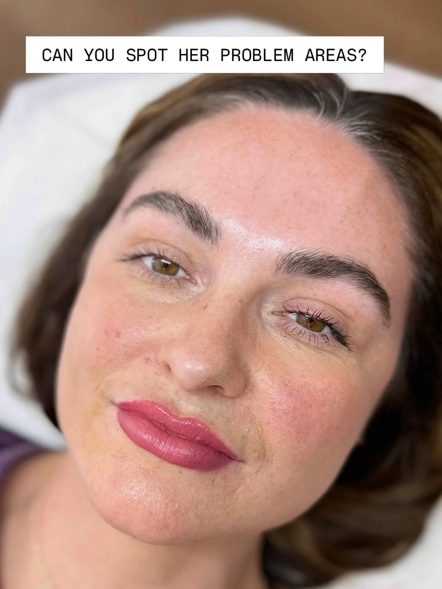Can you spot her problem areas? 

It&rsquo;s important to fill in sparse areas a little more than areas that have more hair. Why? Because if the pigment is uniform throughout the entire brow, the sparse areas can still look sparse when healed. If the