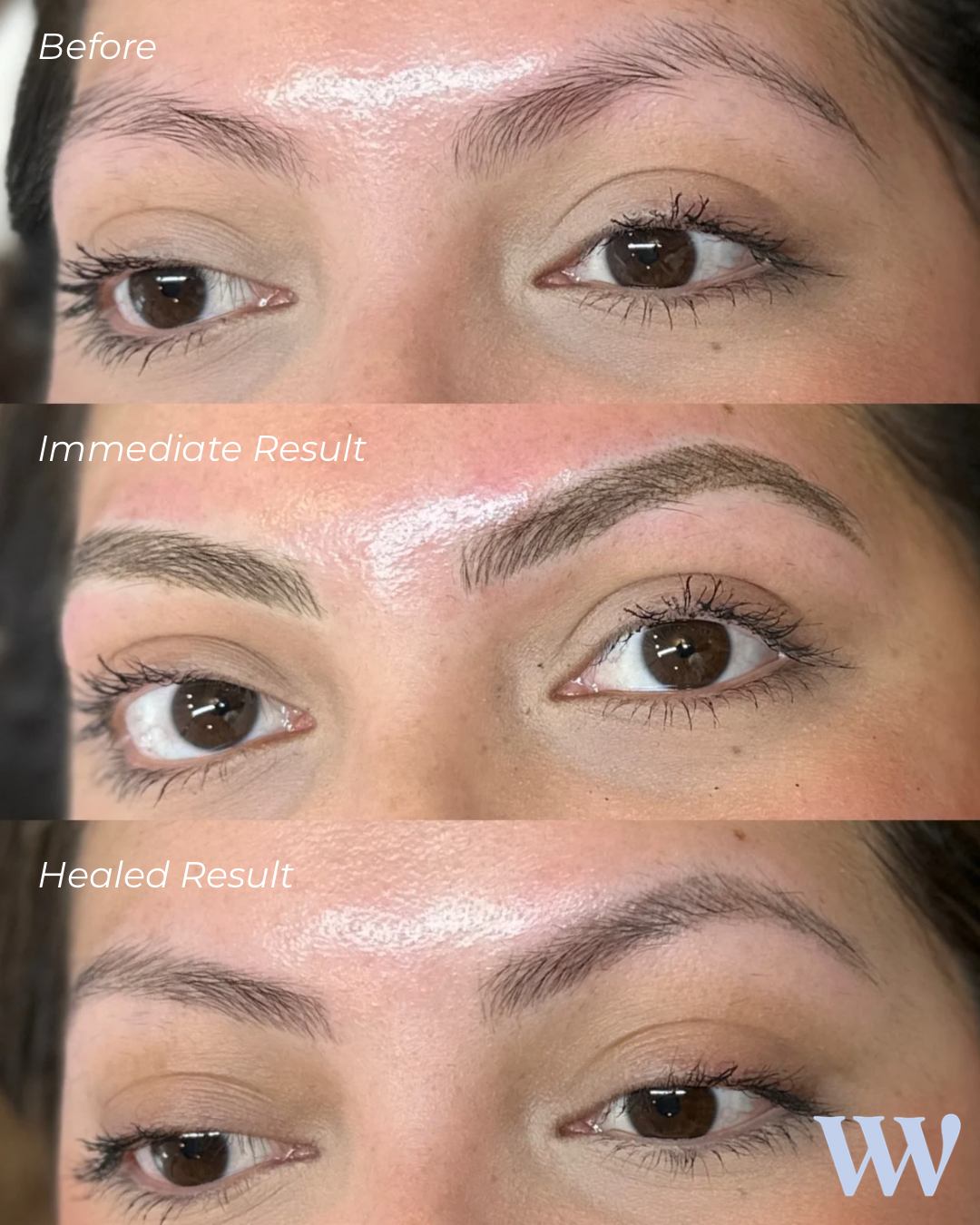 Nano Brows Before, After &amp; Healed: What Do THEY Really Look Like?