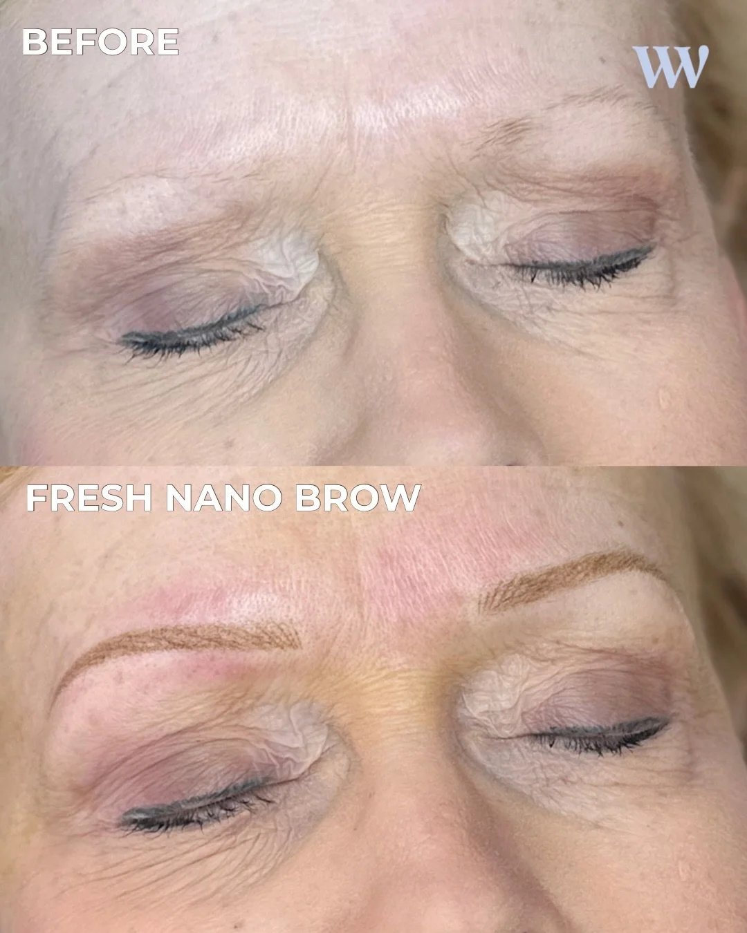 NANO BROW

Soft, natural definition for a client who wanted her brows to look like her, just enhanced. 

Formulated with @hanafy.us Golden Blonde pigment for a warm, true-to-her result.

A few spots left in September &mdash; October is already fillin