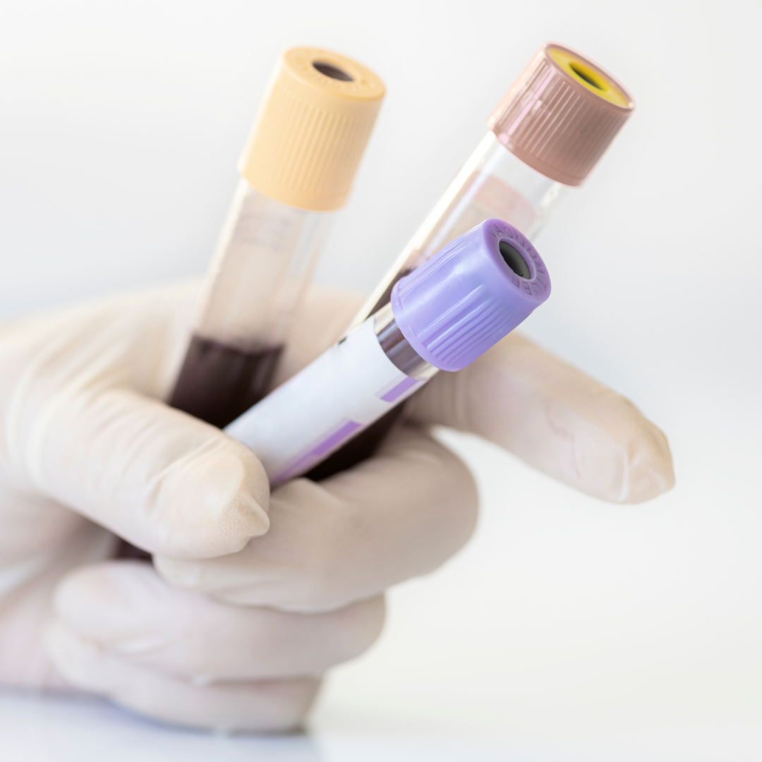 Why Your Blood Work Says “Normal” But You Still Feel Completely Drained