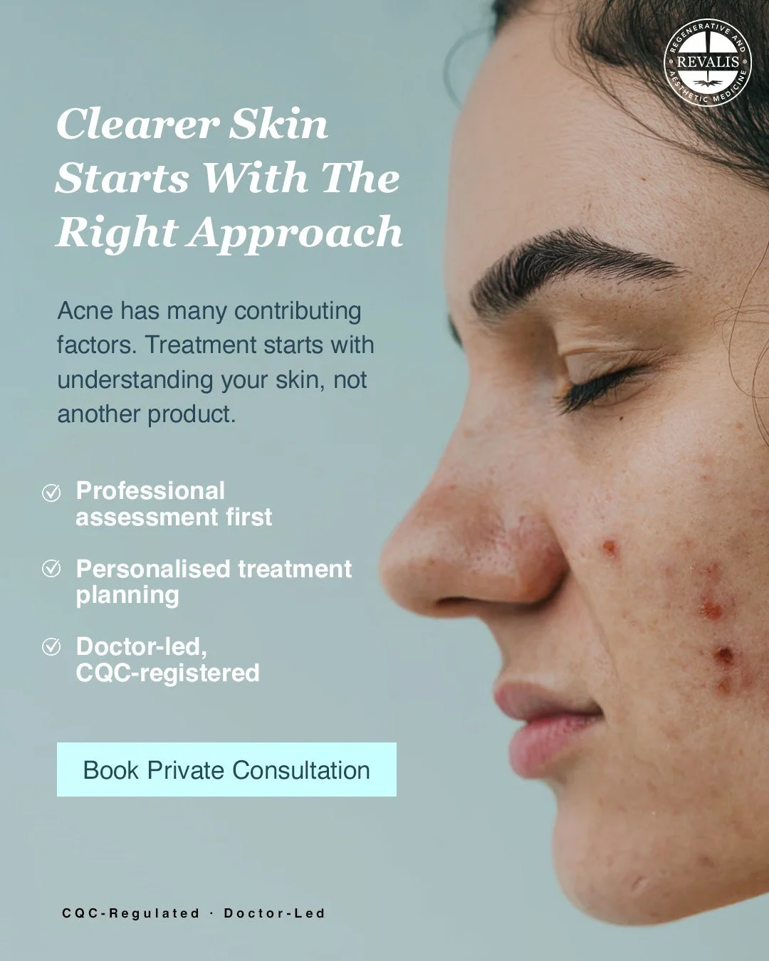 Clearer-looking skin starts with the right clinical approach.

Acne can have a range of contributing factors, which is why effective treatment begins with understanding the skin rather than simply trying another product.

At Revalis Clinic, a CQC-reg