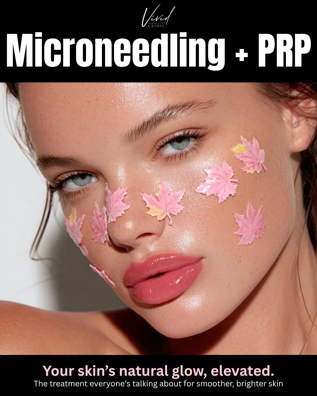 β¨ Microneedling + PRP = Your Skin, Elevated π©Έ
This treatment boosts collagen, smooths texture, and gives you that natural, radiant glow. β¨
π² Call/Text 720-461-1602 to book your appointment today!
β¨ Microneedling + PRP = Tu Piel, Potenciada π©Έ
Est