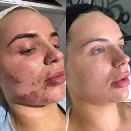 alumier md peels.jpg