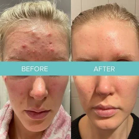 alumier md peels_.jpg