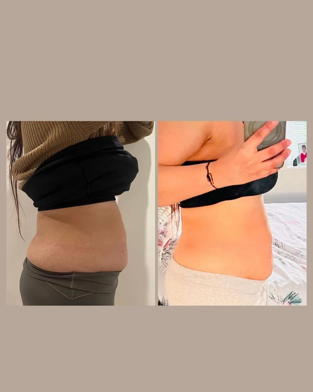 body sculpting x1 session.jpg