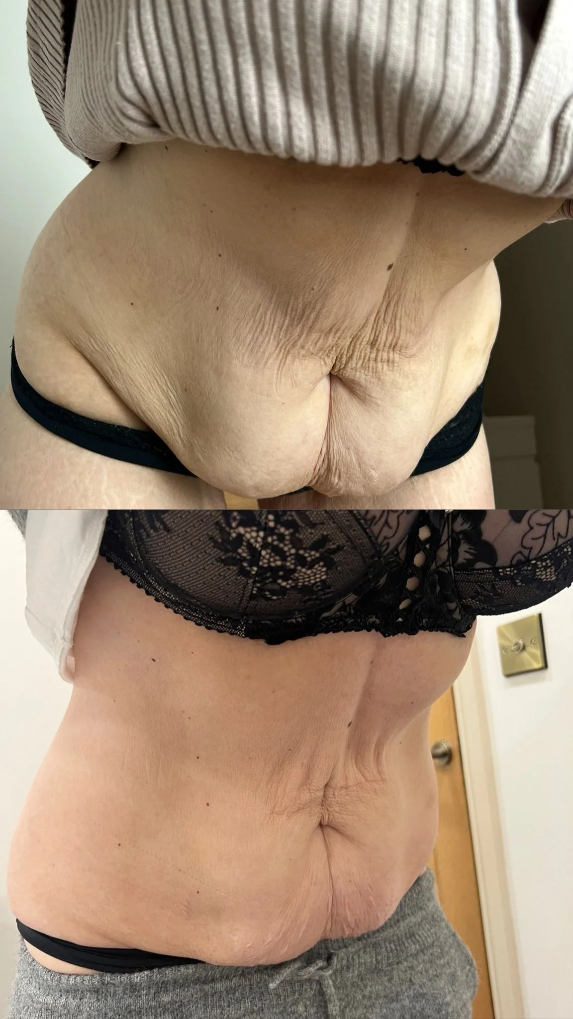 rf + body contouring.jpg
