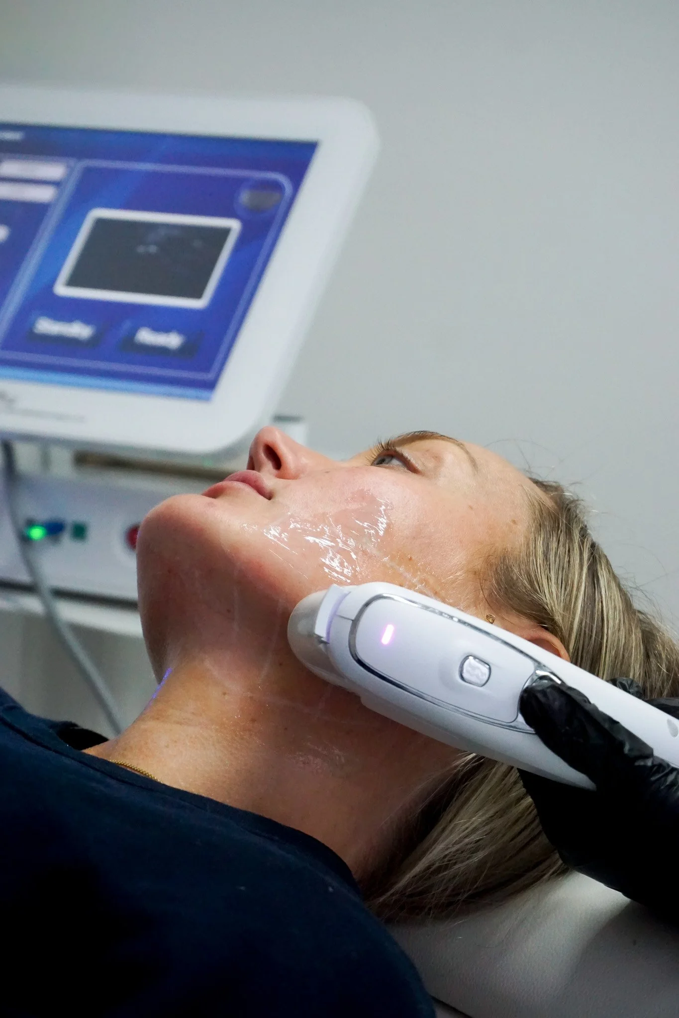 A woman receiving a facial treatment with a handheld device at a medical or spa clinic, with a monitor screen in the background.