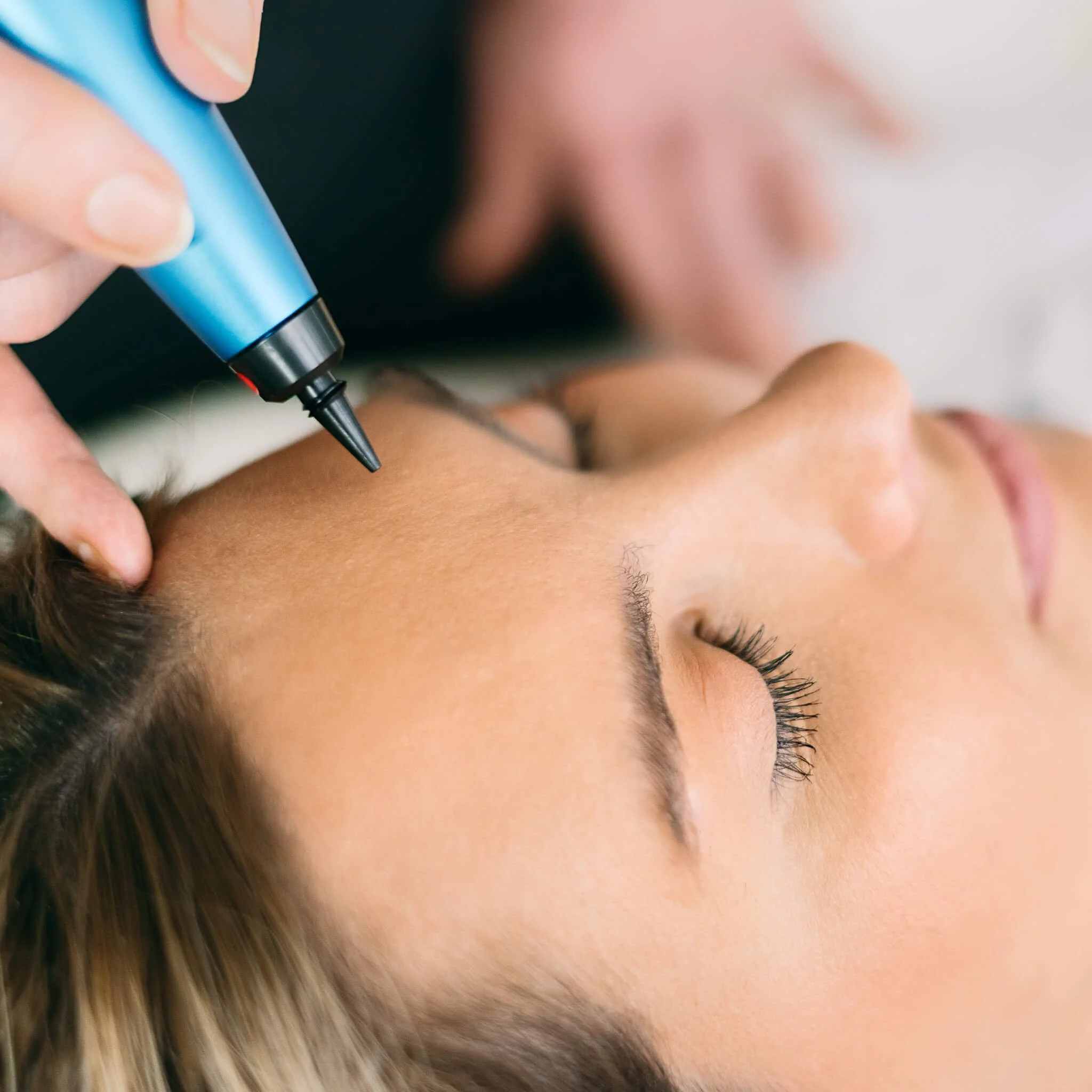 Close-up of a person's face receiving a tattoo or cosmetic procedure on their eyebrow area.