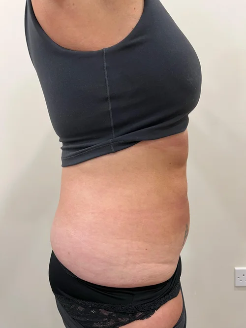 Before image