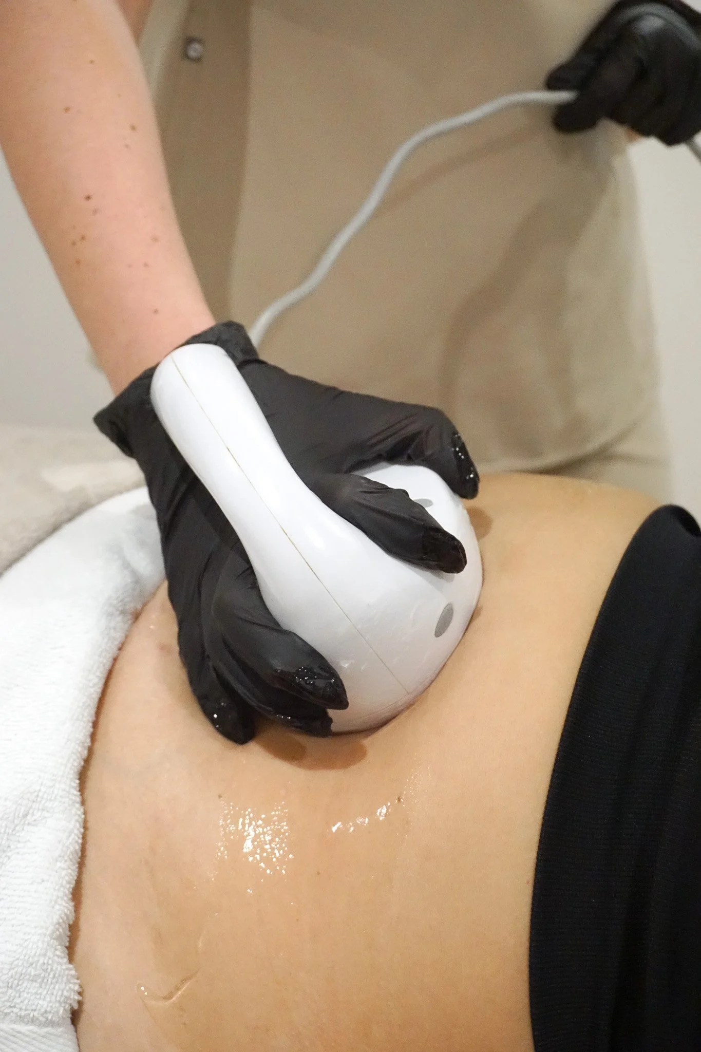 A cosmetic procedure involving a device applying cold or ultrasound to a person's abdomen, with a technician wearing black gloves and holding the device.