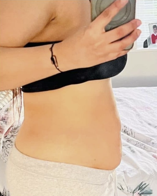 After image