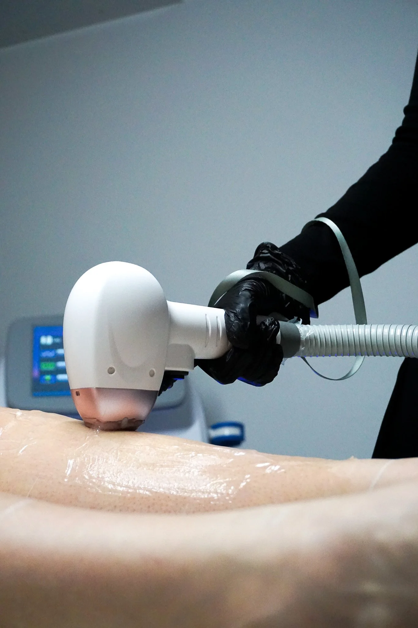 A medical professional in black gloves using a handheld ultrasound device on a patient's abdomen during a medical exam.