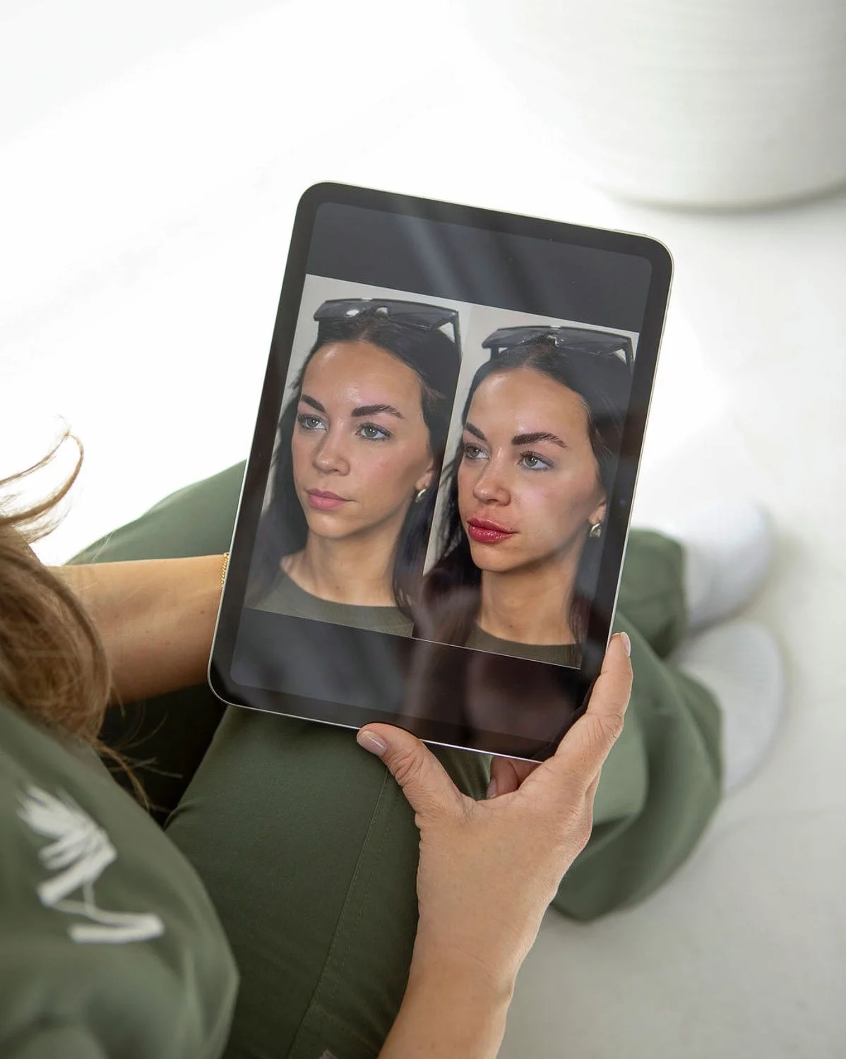 Aesthetics training looking at before and after results.