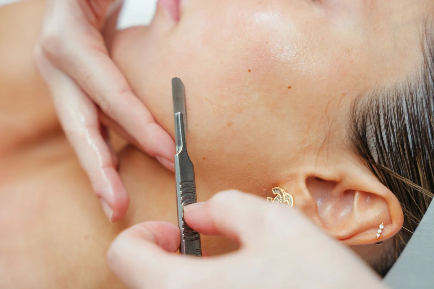 Dermaplane treatments in Scottsdale, AZ.