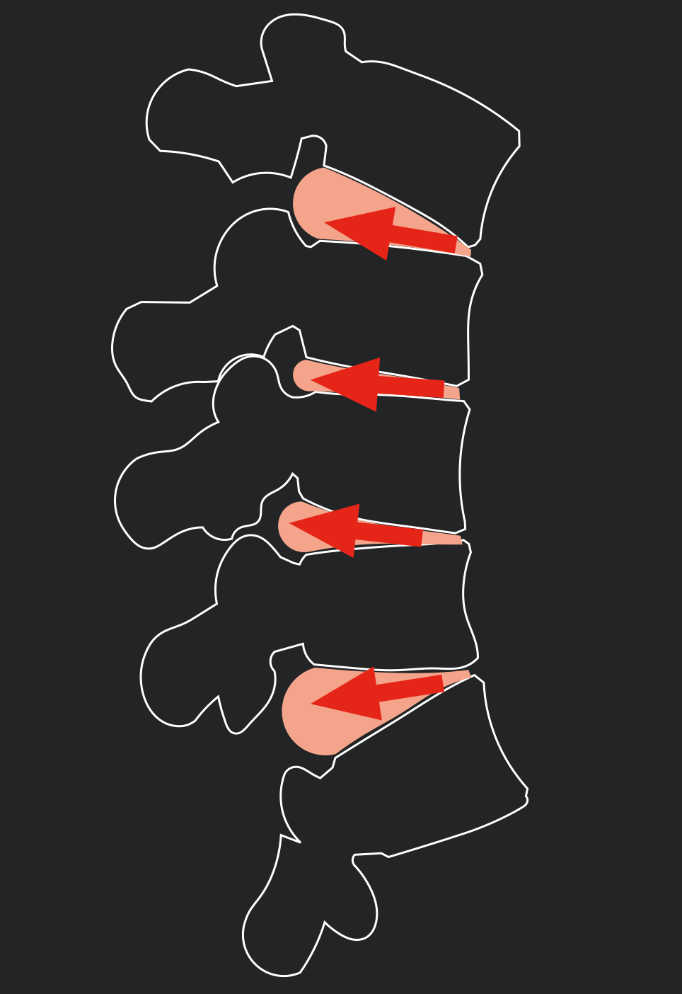 Spine Image.png