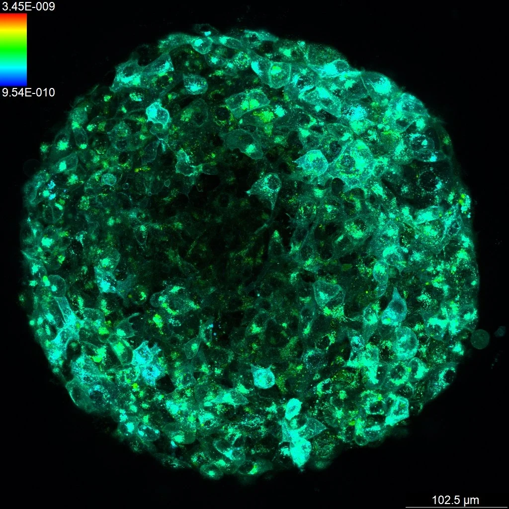 Maximum Projection_ch02.jpg