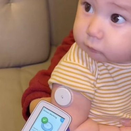 Carbohydrate Composition of Infant Formula Significantly Associated with Blood Sugar Control, CHLA-Led Study Finds