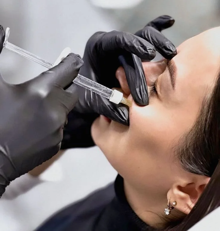 Dermal fillers in Plano, TX for cheek enhancement and natural-looking results