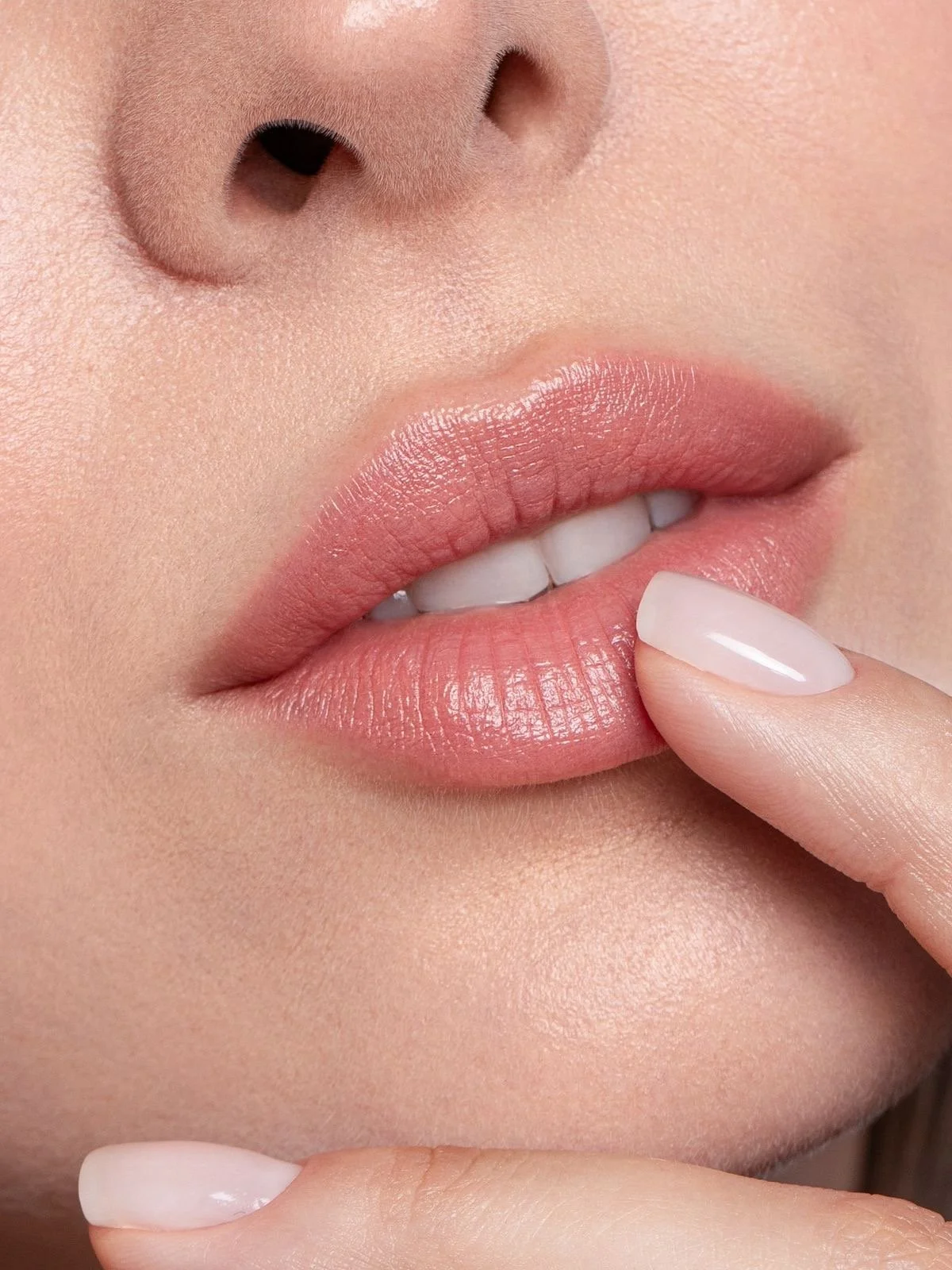 Soft natural lip definition with dermal fillers in Plano Texas