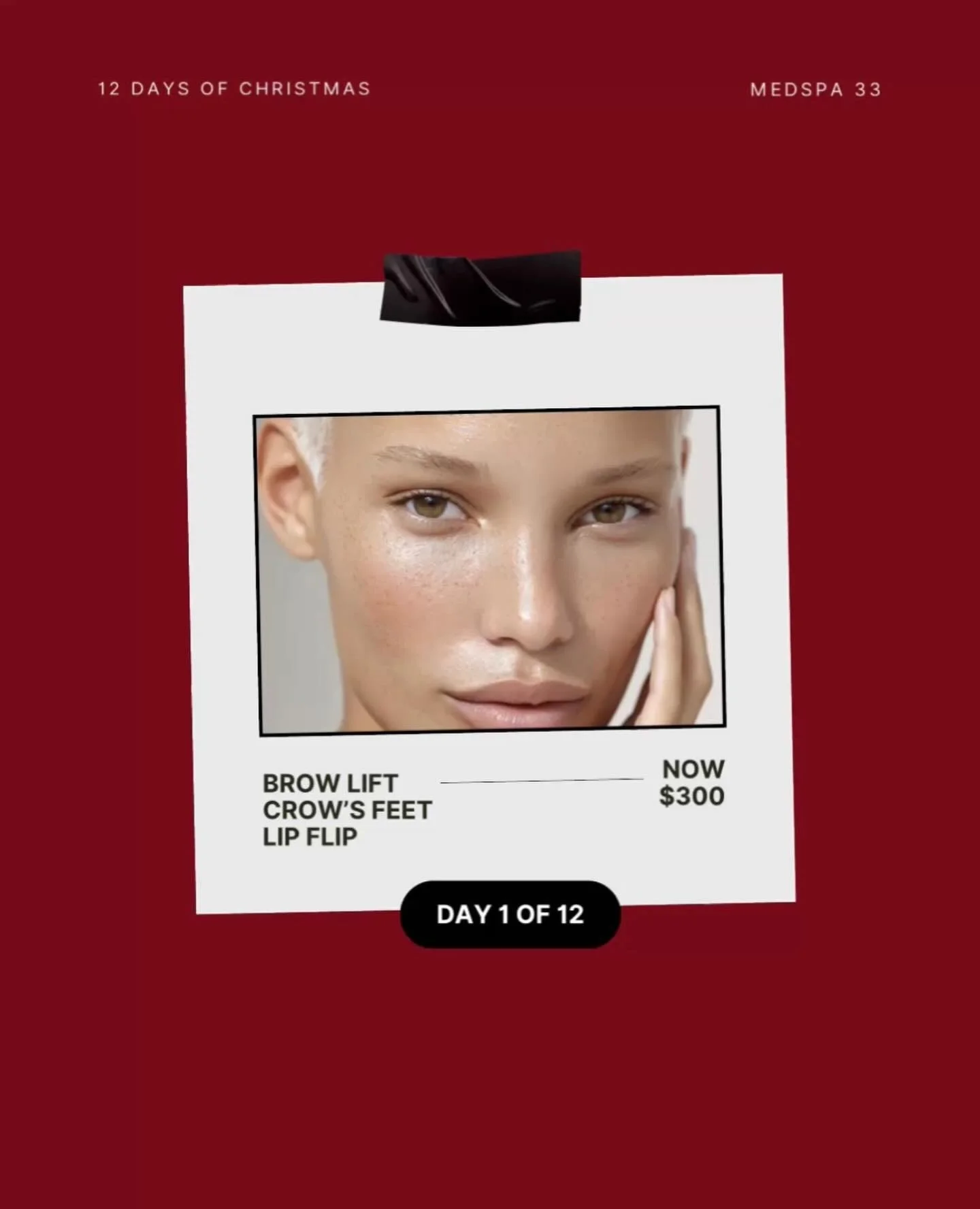 Sleigh All The Way 🪄
.
Get a Brow Lift, Crow&rsquo;s Feet, and a Lip Flip - Now just $300! Choose from your favorite neurotoxin Botox, Dysport, Jeuveau or Xeomin!! Currently available for purchase during our 12-day Christmas celebration!
.
✔️Brow Li