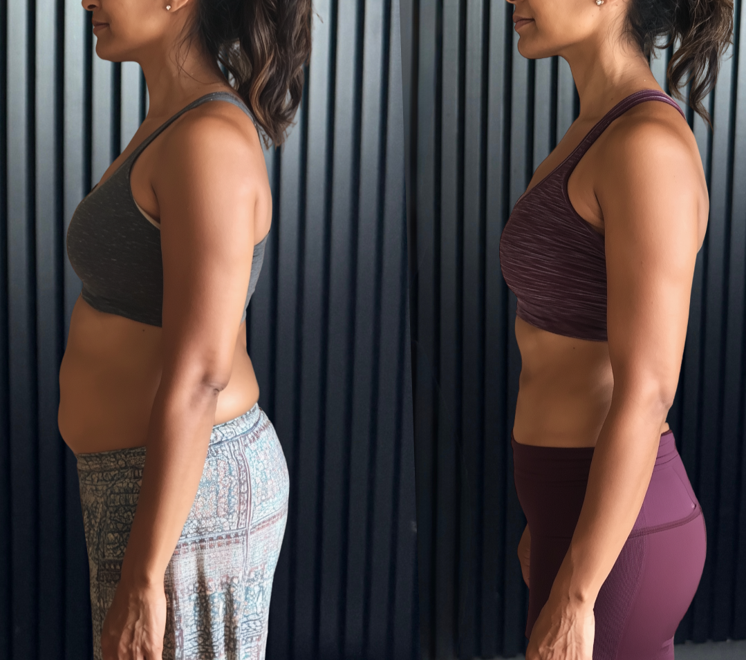 Medical weight management before and after patient results at MEDSPA 33