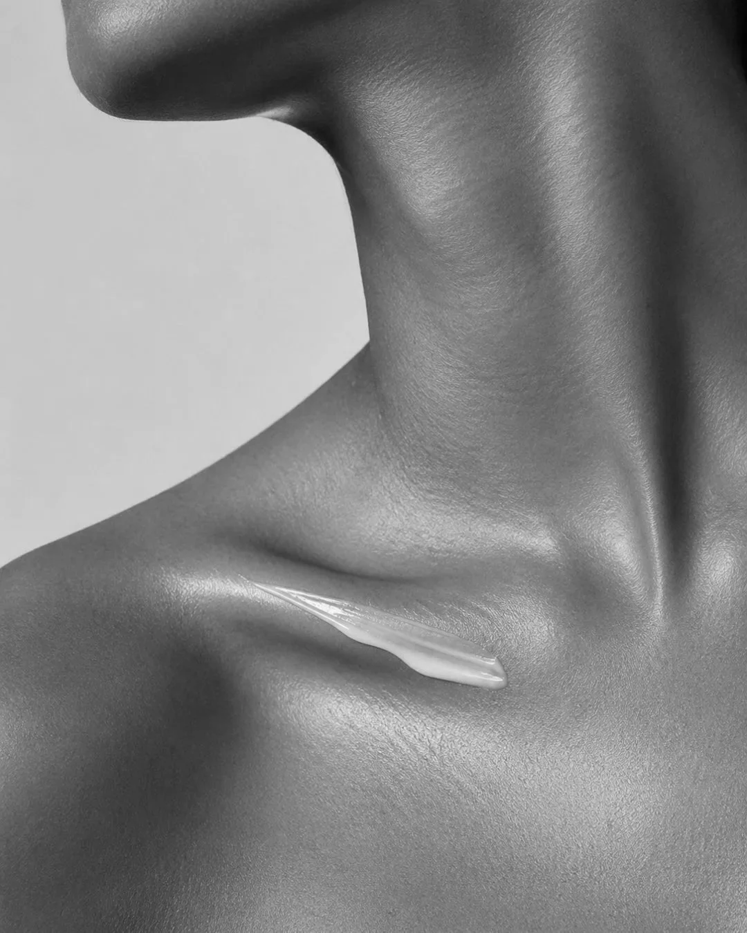IPL treatment for sun damage and pigmentation in Plano, TX