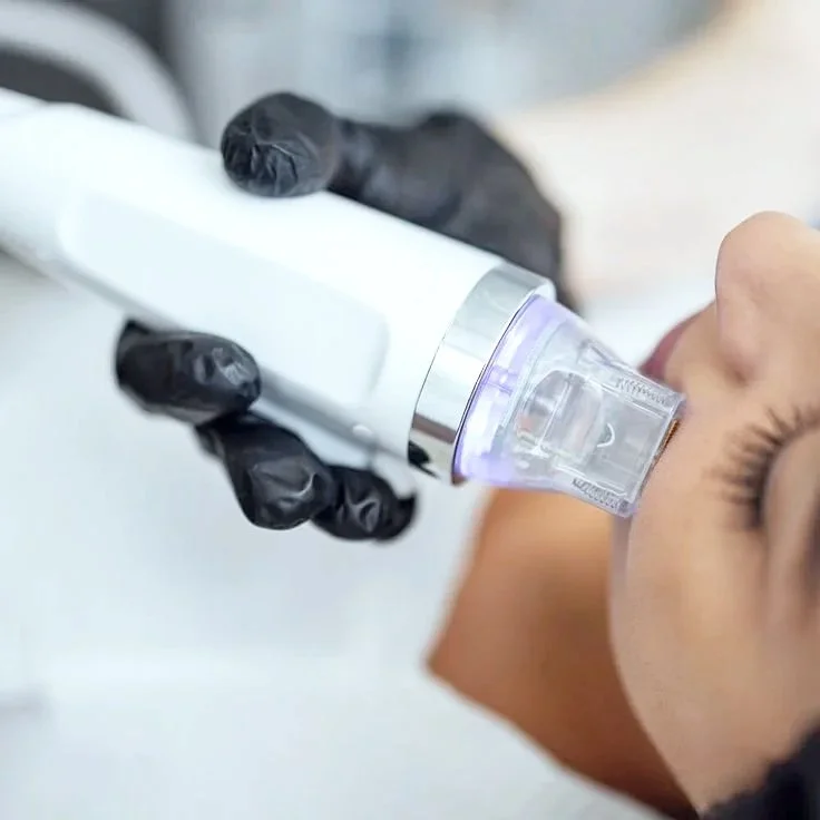 Microneedling in Plano, TX for skin texture improvement