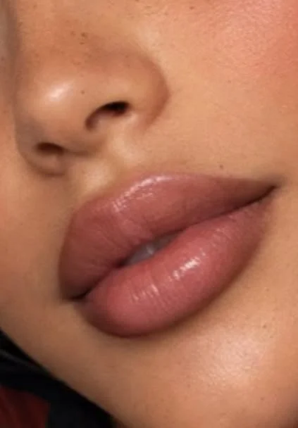 Lip fillers in Plano TX at MEDSPA 33 best medical spa in Plano