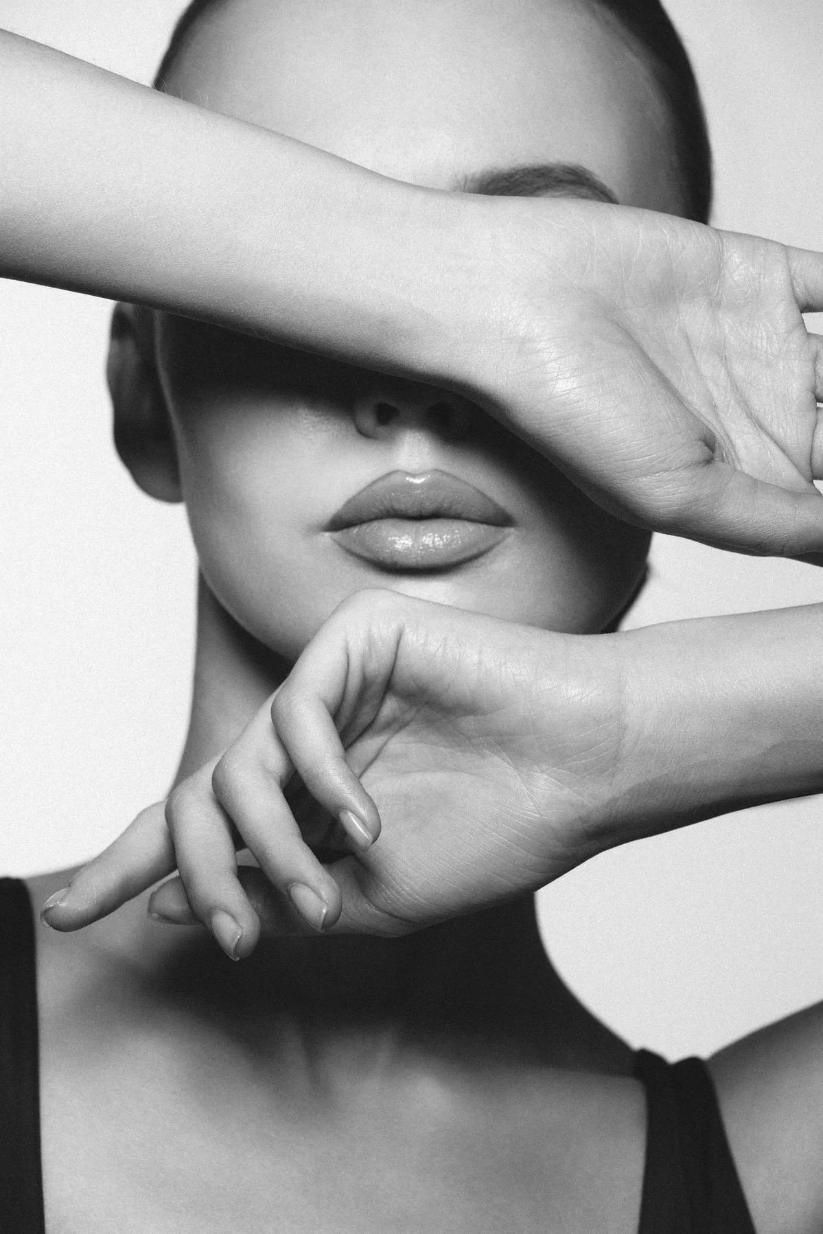 Hyperhidrosis treatment at MEDSPA 33 in Plano, TX