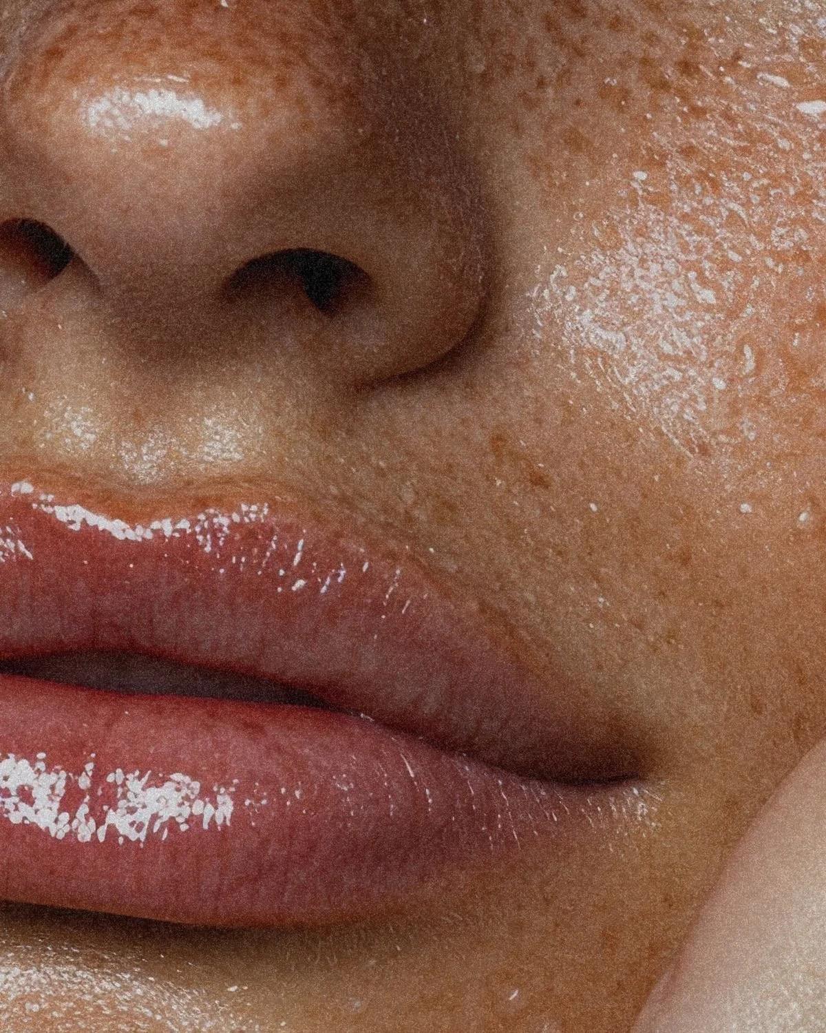 Fuller lips after filler treatment in Plano Texas