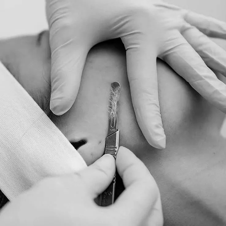 Top med spa in Plano, Texas offering dermaplaning treatments for smooth skin, exfoliation, glowing complexion, and facial rejuvenation at MEDSPA 33.