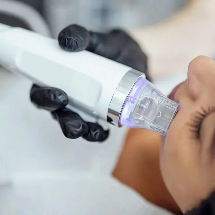Patient receiving collagen induction therapy with microneedling at MEDSPA 33.