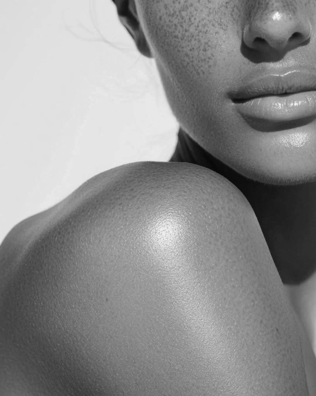 Lip filler injections at MEDSPA 33 in Plano, TX