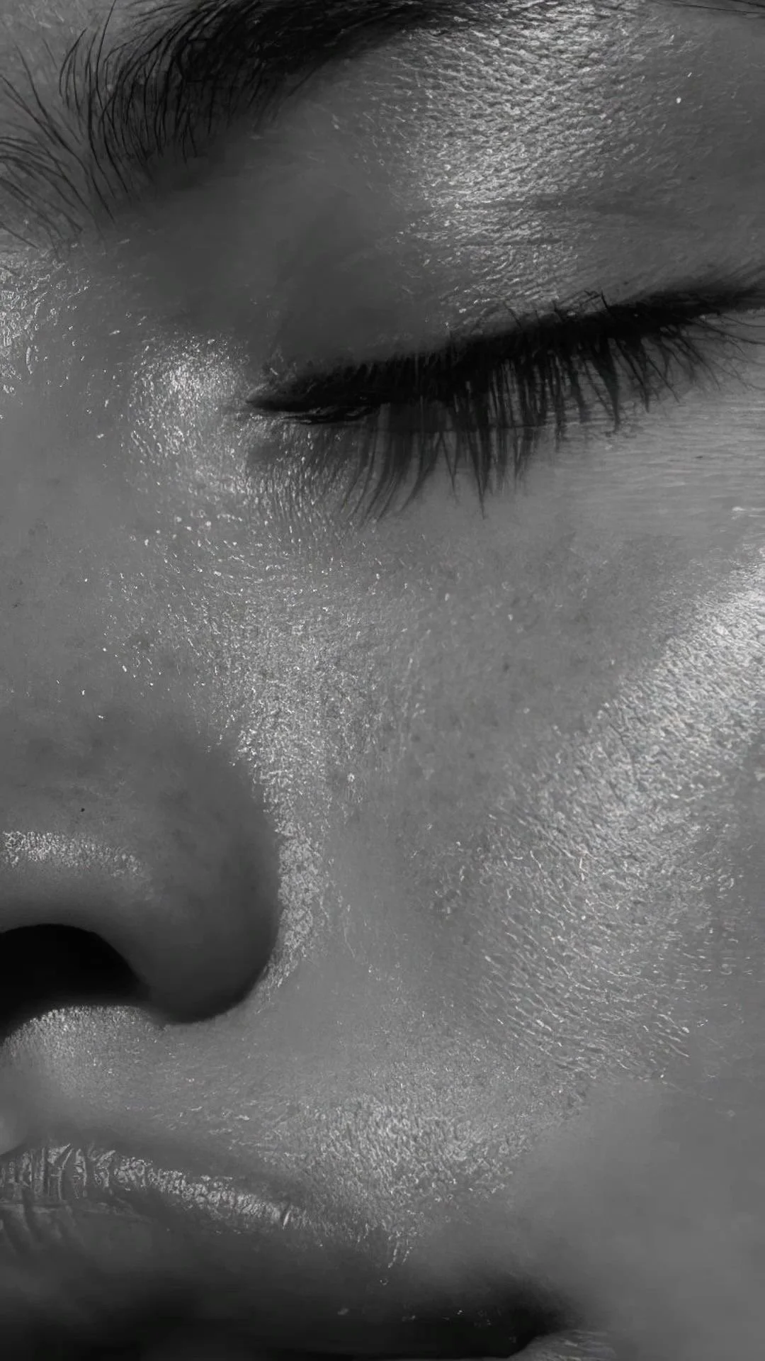 Dysport injections in Plano at MEDSPA 33