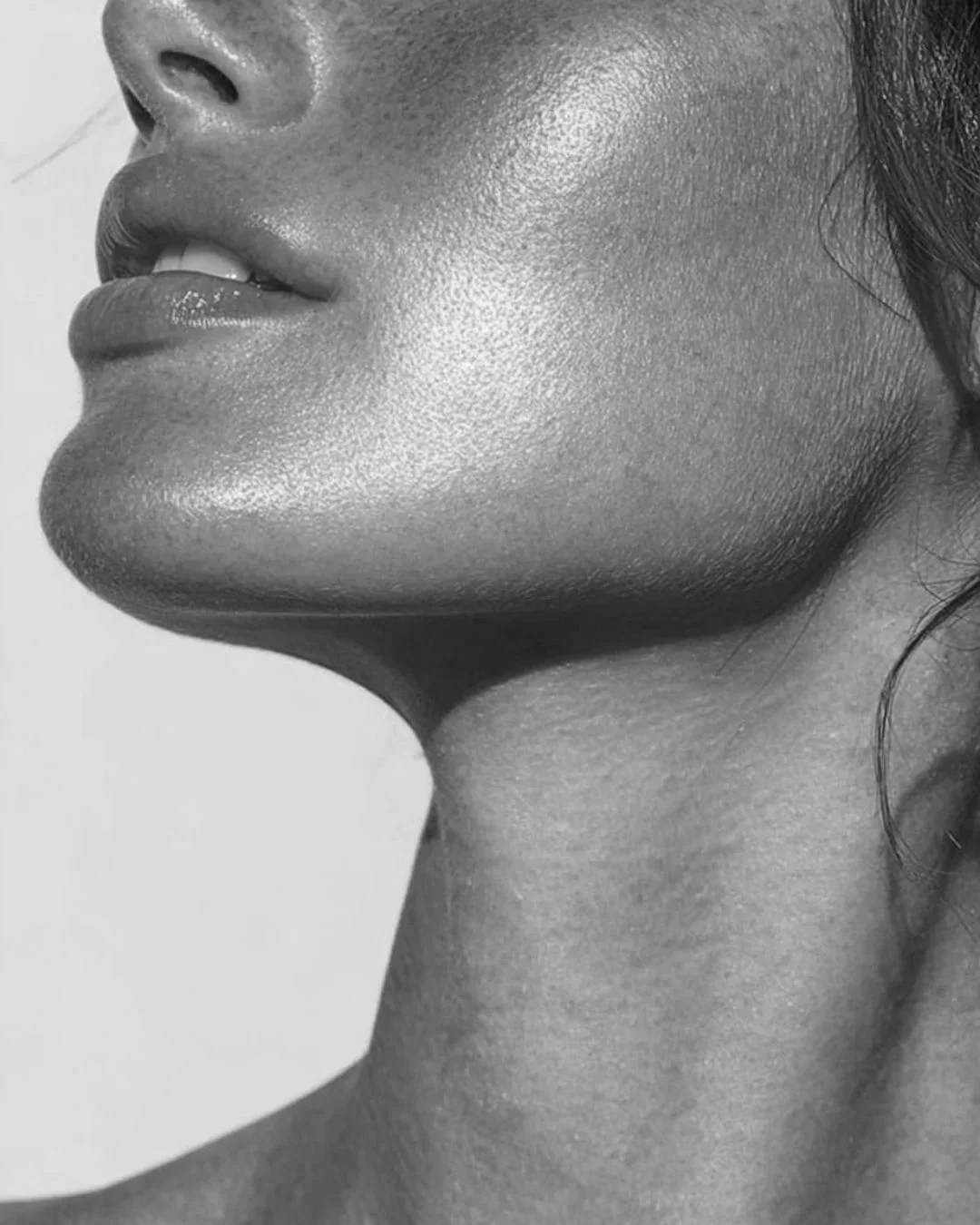 Kybella treatment at MEDSPA 33 in Plano, TX