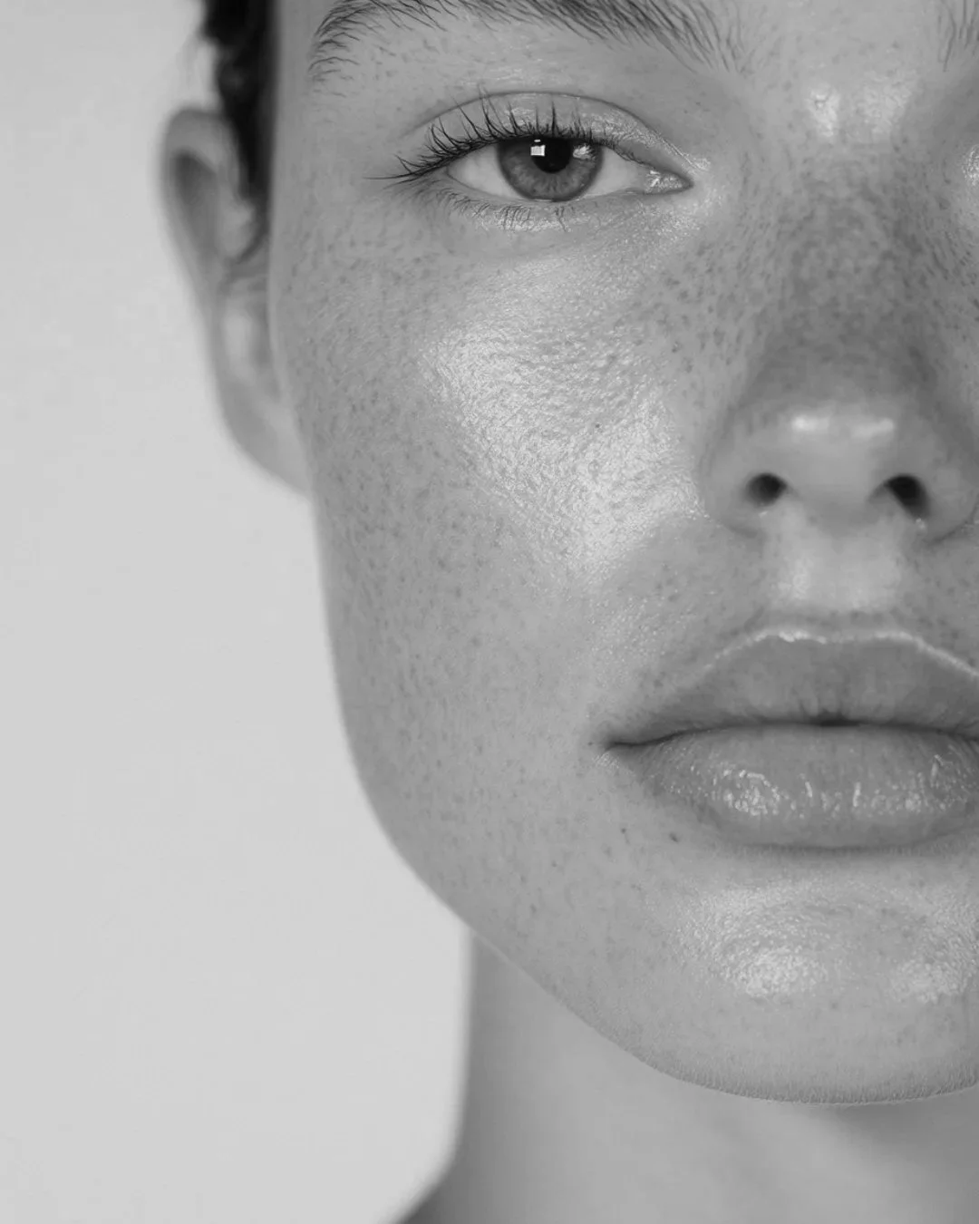 Sculptra at MEDSPA 33 in Plano, TX