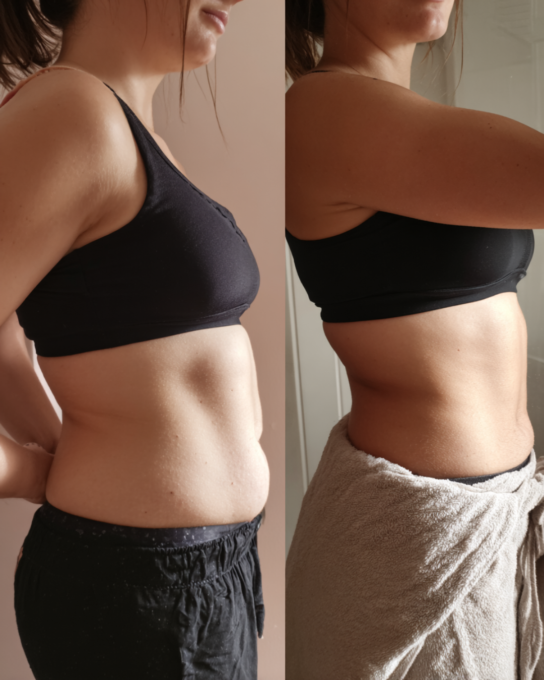 Medical weight loss before and after patient results at MEDSPA 33