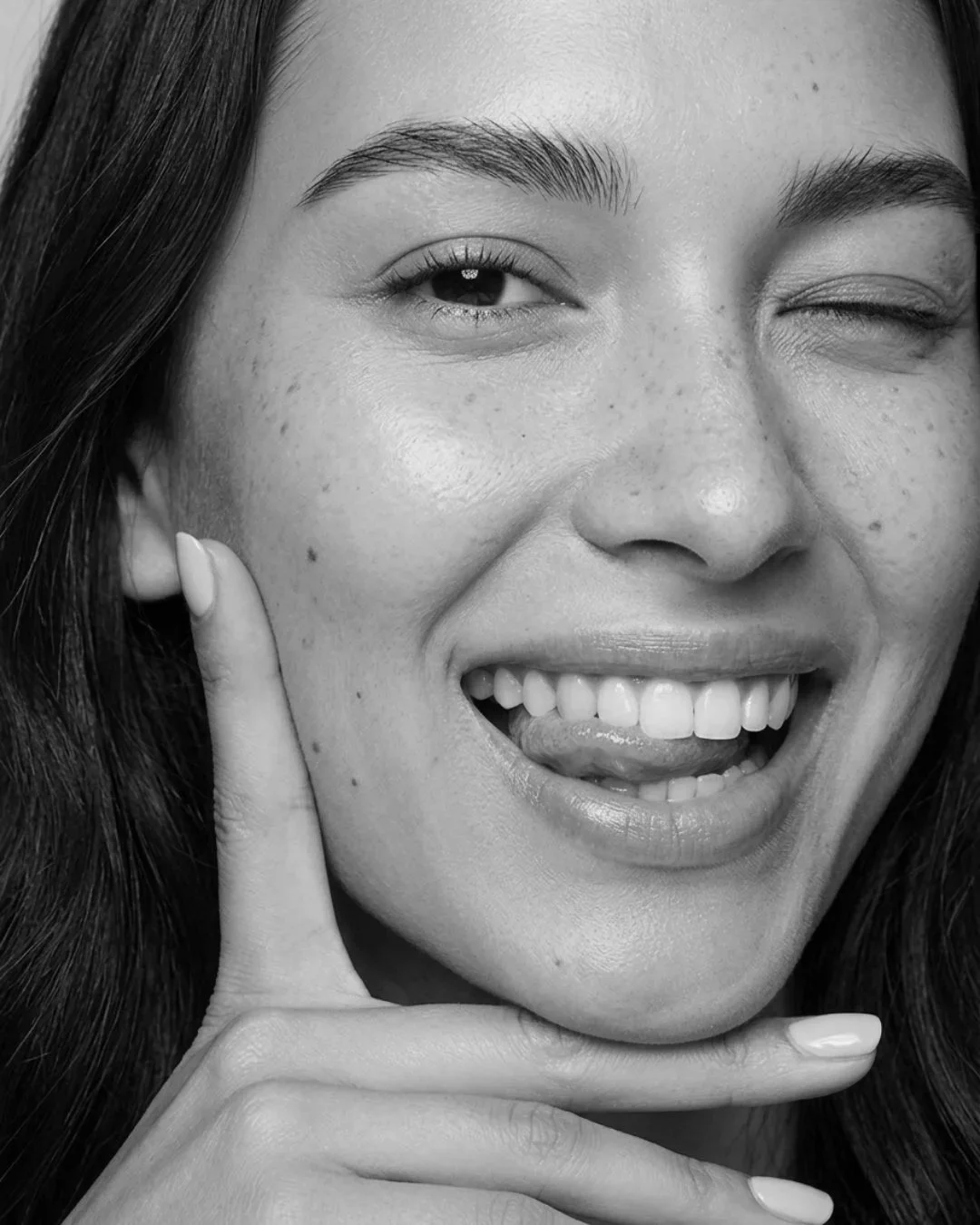 Microneedling treatment at MEDSPA 33 in Plano, TX