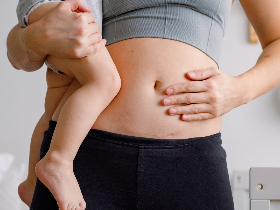 A woman holding a child while standing, with the child's legs wrapped around her waist, and the woman resting her hand on her bare stomach.