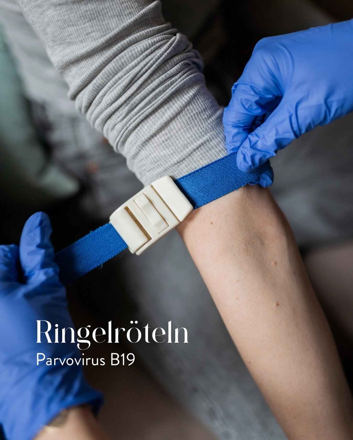 In Kinderg&auml;rten und Schulen treten derzeit vermehrt F&auml;lle von Ringelr&ouml;teln auf, weshalb ich euch unbedingt dar&uuml;ber aufkl&auml;ren m&ouml;chte. &hearts;️

Ringelr&ouml;teln, verursacht durch das Parvovirus B19, z&auml;hlen zu den f