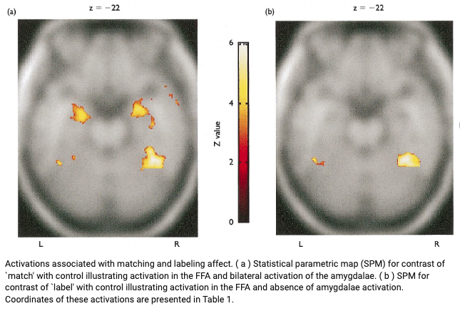 Name It to Tame It: How Putting Anxiety Into Words Calms the Brain's Fear Response (a Study)