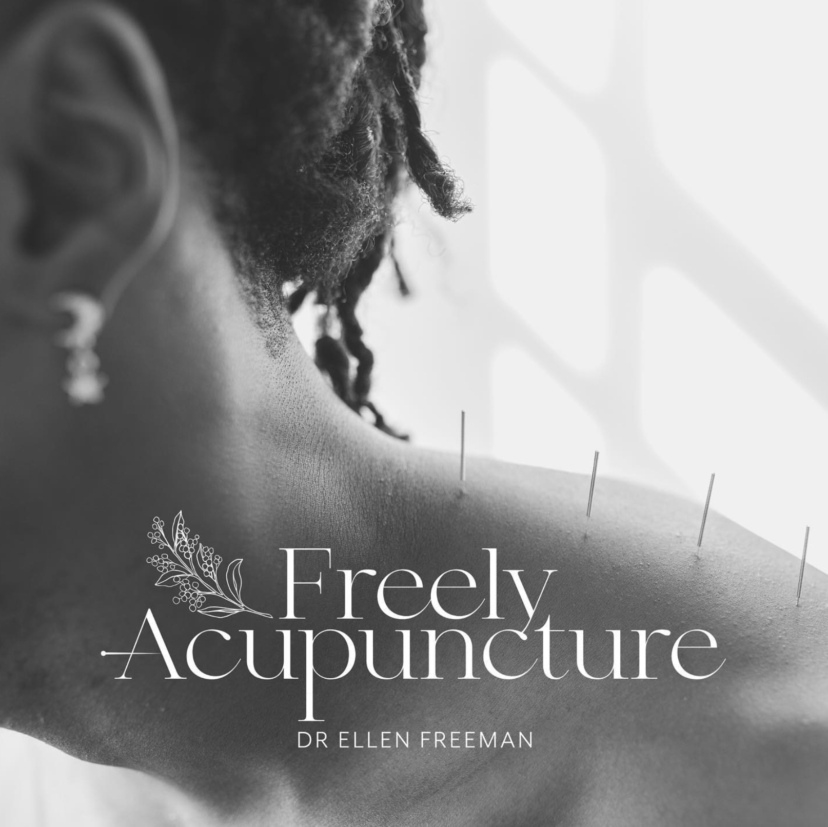 Freely Acupuncture
